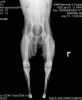 Nazwa pliku=RTG_Crystal..JPG
Wielkość pliku=43KiB
Rozmiar=636x775
Data dodania= 23, Maj 2008 RTG_Crystal..JPG